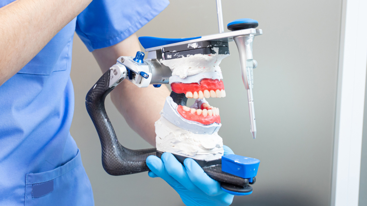 噛み合わせの分析