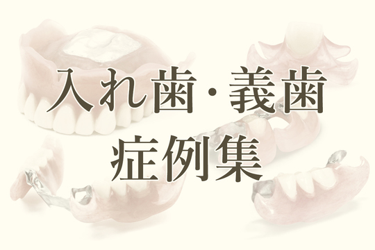 義歯　入れ歯　見本 目立たない、噛みやすい入れ歯・義歯の症例集 - 新橋入れ歯専門外来