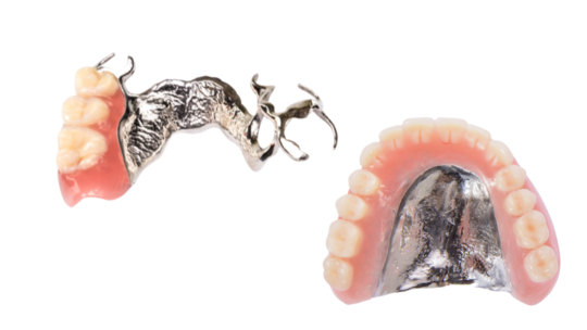 金属床義歯・入れ歯の値段とデメリット（チタン床とコバルトクロム）