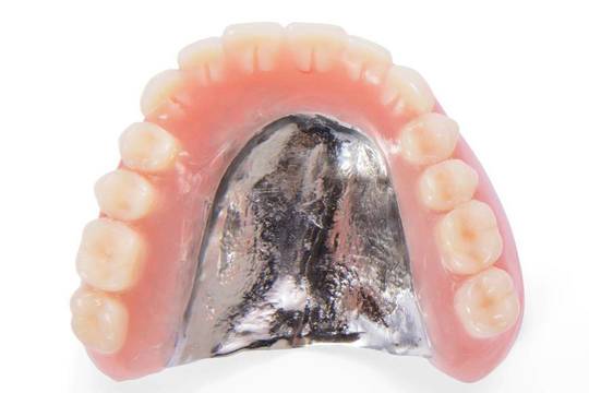 金属床義歯・入れ歯の値段とデメリット（チタン床とコバルトクロム）